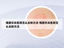 嘴唇长白色斑怎么去除方法 嘴唇长白色斑怎么去除方法