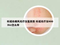 科诺白癜风光疗仪是真假 科诺光疗仪4003b2怎么样