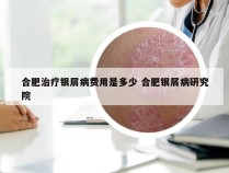 合肥治疗银屑病费用是多少 合肥银屑病研究院