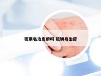 硫磺皂治皮癣吗 硫磺皂治藓