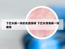 下巴长癣一样的东西很痒 下巴长得像癣一样瘙痒