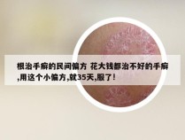 根治手癣的民间偏方 花大钱都治不好的手癣,用这个小偏方,就35天,服了!