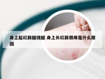 身上起红藓越挠越 身上长红藓很痒是什么原因