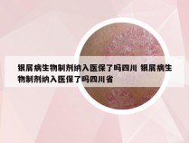 银屑病生物制剂纳入医保了吗四川 银屑病生物制剂纳入医保了吗四川省