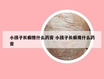 小孩子长癣擦什么药膏 小孩子长癣用什么药膏