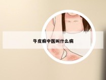 牛皮癣中医叫什么病