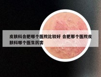 皮肤科合肥哪个医院比较好 合肥那个医院皮肤科哪个医生厉害