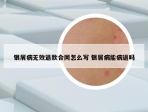 银屑病无效退款合同怎么写 银屑病能病退吗