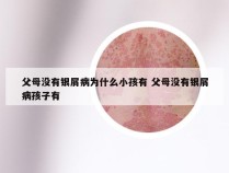 父母没有银屑病为什么小孩有 父母没有银屑病孩子有