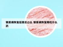 银屑病恢复后需忌口么 银屑病恢复期吃什么药