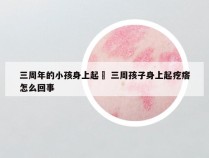 三周年的小孩身上起廯 三周孩子身上起疙瘩怎么回事