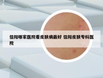 信阳哪家医院看皮肤病最好 信阳皮肤专科医院