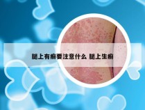 腿上有癣要注意什么 腿上生癣