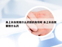 身上长白斑用什么药擦的有效呢 身上长白斑要擦什么药