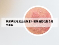 银屑病能吃复合维生素b 银屑病能吃复合维生素吗