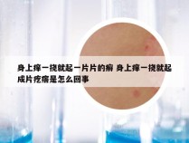 身上痒一挠就起一片片的癣 身上痒一挠就起成片疙瘩是怎么回事