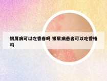 银屑病可以吃香春吗 银屑病患者可以吃香椿吗