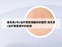 维生素a与c治疗银屑病最好的医院 维生素c治疗银屑病中的应用