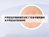 卢传坚治疗银屑病可以吗 广东省中医院副院长卢传坚治疗脱发好吗