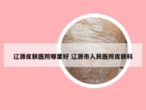 辽源皮肤医院哪里好 辽源市人民医院皮肤科