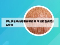 掌趾脓包病的危害有哪些呢 掌趾脓包病是什么症状