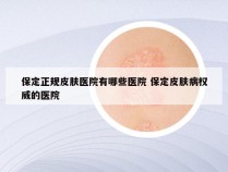 保定正规皮肤医院有哪些医院 保定皮肤病权威的医院