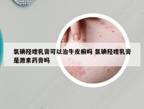 氯碘羟喹乳膏可以治牛皮癣吗 氯碘羟喹乳膏是激素药膏吗