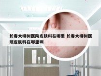 长春大柳树医院皮肤科在哪里 长春大柳树医院皮肤科在哪里啊