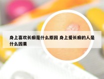 身上喜欢长癣是什么原因 身上爱长癣的人是什么因果