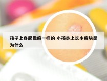 孩子上身起像癣一样的 小孩身上长小癣块是为什么