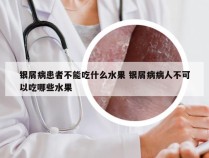 银屑病患者不能吃什么水果 银屑病病人不可以吃哪些水果