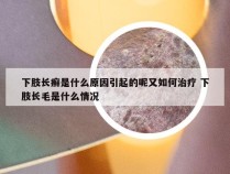 下肢长癣是什么原因引起的呢又如何治疗 下肢长毛是什么情况