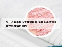 为什么会出现泛发性银屑病 为什么会出现泛发性银屑病的原因