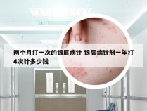 两个月打一次的银屑病针 银屑病针剂一年打4次针多少钱