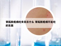 掌跖脓疱病吃食禁忌什么 掌跖脓疱病不能吃的东西