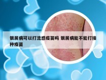 银屑病可以打流感疫苗吗 银屑病能不能打接种疫苗