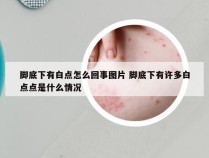 脚底下有白点怎么回事图片 脚底下有许多白点点是什么情况