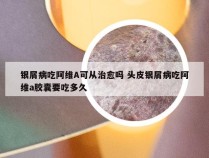 银屑病吃阿维A可从治愈吗 头皮银屑病吃阿维a胶囊要吃多久