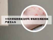 十年的掌跖脓疱能治好吗 掌跖脓包病越来越严重怎么办