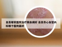 自贡哪家医院治疗银血病好 自贡市心血管内科哪个医院最好