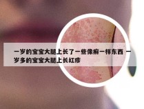 一岁的宝宝大腿上长了一些像癣一样东西 一岁多的宝宝大腿上长红疹