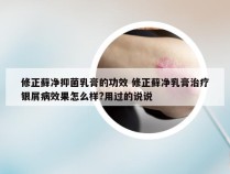 修正藓净抑菌乳膏的功效 修正藓净乳膏治疗银屑病效果怎么样?用过的说说