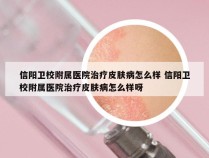 信阳卫校附属医院治疗皮肤病怎么样 信阳卫校附属医院治疗皮肤病怎么样呀