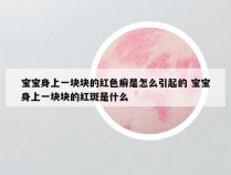 宝宝身上一块块的红色癣是怎么引起的 宝宝身上一块块的红斑是什么