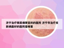 济宁治疗银屑病便宜的的医院 济宁市治疗皮肤病最好的医院是哪里