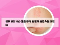 银屑病影响办健康证吗 有银屑病能办健康证吗