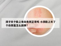 孩子长个脸上有白色斑正常吗 小孩脸上长了个白斑是怎么回事?