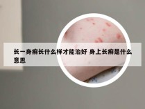 长一身癣长什么样才能治好 身上长癣是什么意思