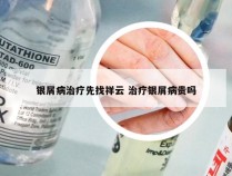 银屑病治疗先找祥云 治疗银屑病贵吗