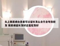 头上银屑病女患者可以留长发么会不会导致脱发 银屑病留长发好还是短发好